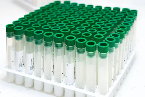 Covid-19 outbreak blood test. Close up view of empty test tubes for blood samples of Coronavirus patients, on a rack. — Stock Photo, Image