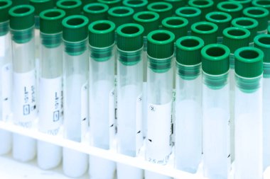 Covid-19 salgın kan testi. Coronavirus hastalarının kan örnekleri için boş test tüplerine yakından bakın..