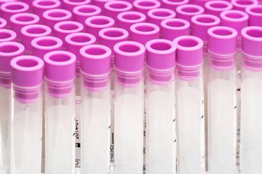 Covid-19 salgın kan testi. Coronavirus hastalarının kan örnekleri için boş test tüplerine yakından bakın..