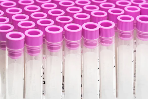 Teste de sangue de surto de Covid-19. Visão detalhada de tubos de ensaio vazios para amostras de sangue de pacientes com Coronavirus, em um rack . — Fotografia de Stock