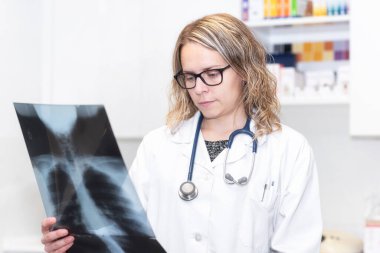 Covid-19. Bir hastanın akciğerlerinin röntgenini tutan kadın doktor. Akciğer hastalıklarının tespiti, zatürree ve koronovirüs teşhisi.
