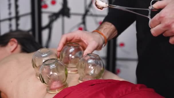 Tradycyjna chińska medycyna. Cupping terapii, leczenie stosowane w celu łagodzenia bólu i innych świadczeń zdrowotnych. — Wideo stockowe