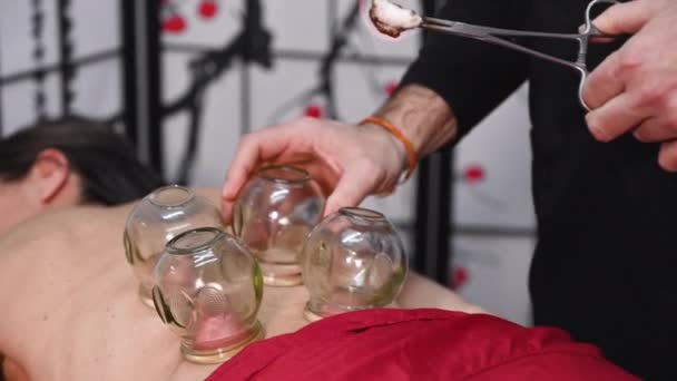 Terapia tradicional de medicina chinesa. Cupping terapia, um tratamento usado para o alívio da dor e outros benefícios para a saúde. — Vídeo de Stock