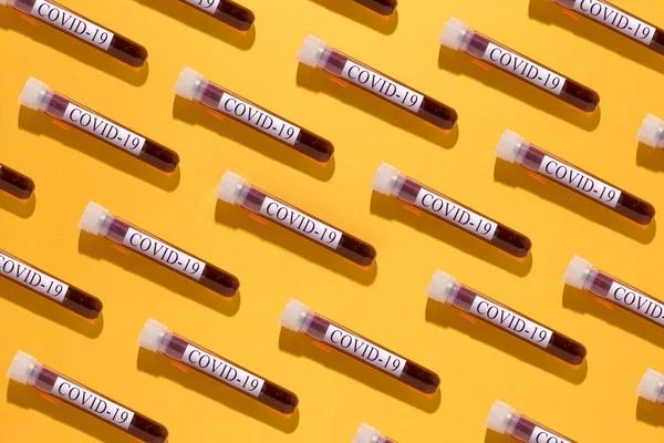 Medical Background Aligned Coronavirus Test Tubes Labelled Covid Blood Samples — Stock Photo, Image