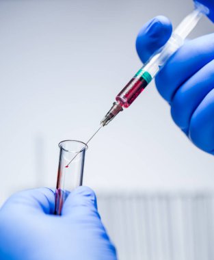 Insertion of a solution into a test tube