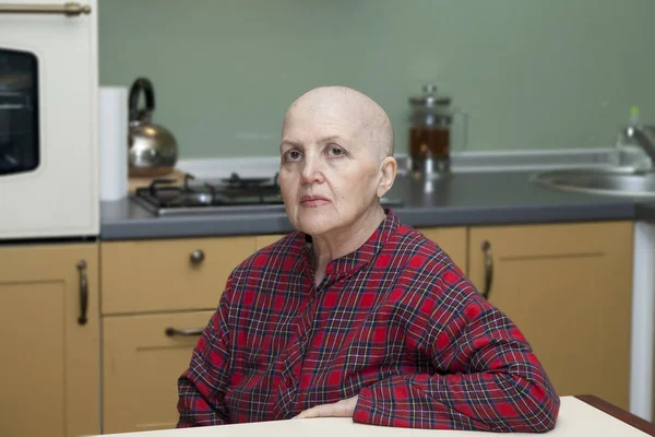 Ancianos sonriendo con la cabeza calva en casa después de la quimioterapia — Foto de Stock