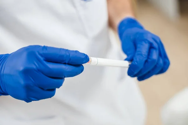 Visão de perto do esfregaço de DNA da saliva nas mãos dos médicos — Fotografia de Stock