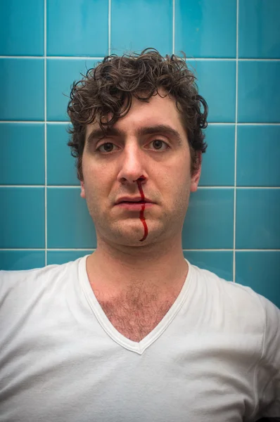 Man Bloody Nose — Stock Photo, Image