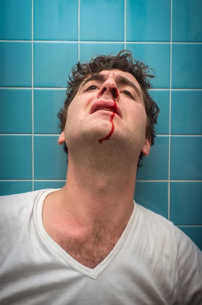 Man Bloody Nose — Stock Photo, Image