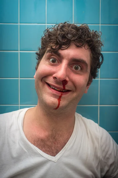 Кровавый нос человека — стоковое фото