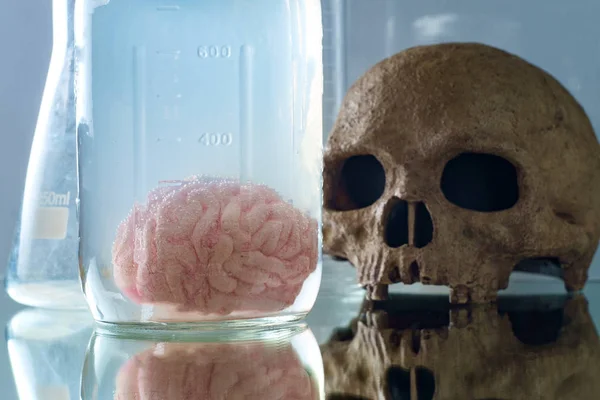 Zachowany słoik ludzkiego mózgu — Zdjęcie stockowe