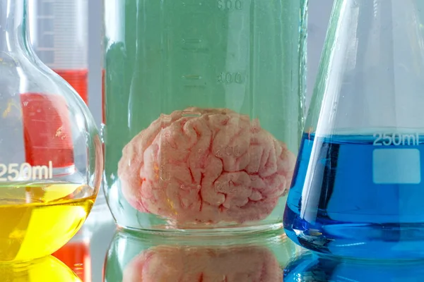 Preserved Human Brain Jar — 스톡 사진