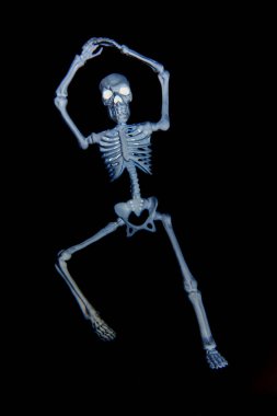 İskelet X ışını dans