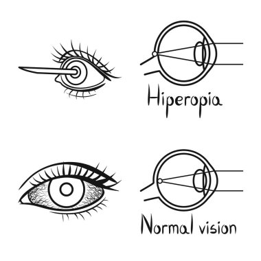Düzeltme ve optometri işaretinin izole edilmiş nesnesi. Web için düzeltme ve vizyon stok sembolü kümesi.