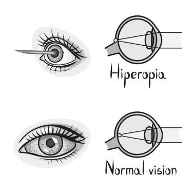 Görüş ve düzeltme simgesinin vektör illüstrasyonu. Stok için görme ve optometri vektör simgesi koleksiyonu.