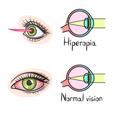 Görüş ve düzeltme simgesinin vektör illüstrasyonu. Web için görüş ve optometrist hisse simgesi kümesi.