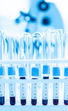 Laboratuvar odasında, Covid -19 virüsü bulaşıcı hastalık test tüpü. Corona tedavisi krizinde laboratuvarda analiz için numune. İnsan hayatını kurtarmak için sağlık teknolojisi için mavi tonlu fotoğraf fikri.