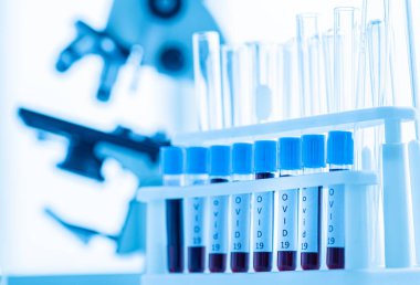 Laboratuvar odasında, Covid -19 virüsü bulaşıcı hastalık test tüpü. Corona tedavisi krizinde laboratuvarda analiz için numune. İnsan hayatını kurtarmak için sağlık teknolojisi için mavi tonlu fotoğraf fikri.