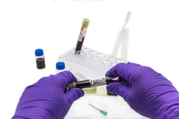 Základní Lékařská Péče Bílém Podkladě Ebolového Testu Koronavirus Covid Pro — Stock fotografie