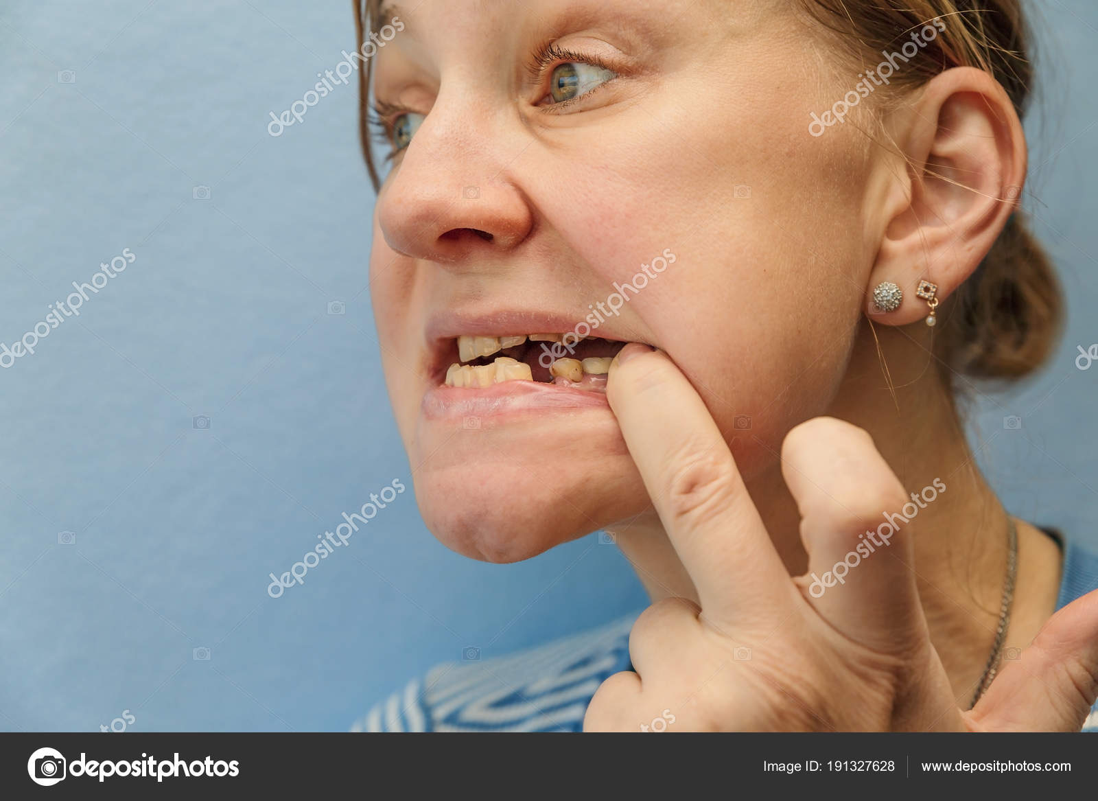 Women without teeth