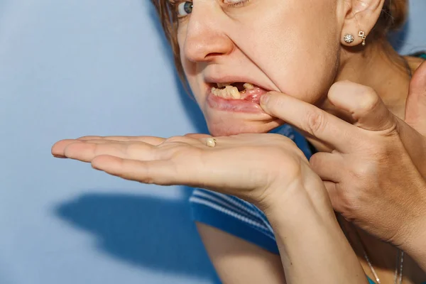 bırakılan diş taç kadınla