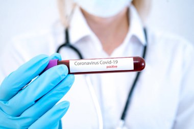 Doktor, Coronavirus 2019-ncov 'un laboratuara hızla yayılmasının pozitif kan testi sonucunu içeren tıbbi eldiven tüpünü getirdi. Coronavirus Covid-19 salgını. Tıp ve salgın konsepti.