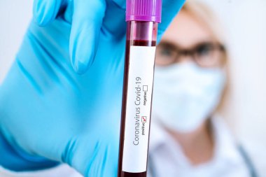 Coronavirus Covid-19 salgını. Tıp ve salgın konsepti. Pozitif kan testi sonuçları, koruyucu yüz maskesi, ilaç hapları, steteskop, şişe ve şırınga, laboratuvarda aşı....