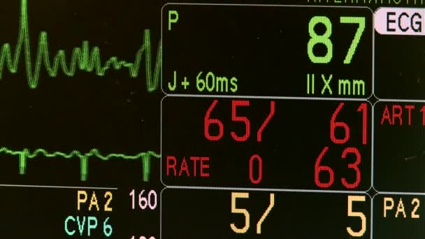 Fondo Los Cardiogramas — Vídeo de stock