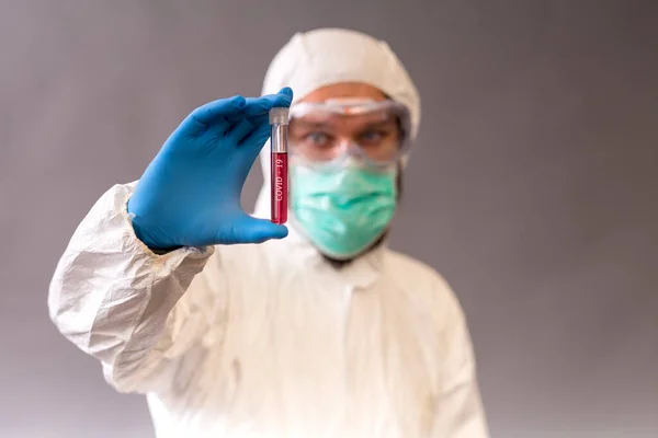 Male Doctor Surgical Mask Goggles Protective Suit Holding Blood Samples — Stock Photo, Image