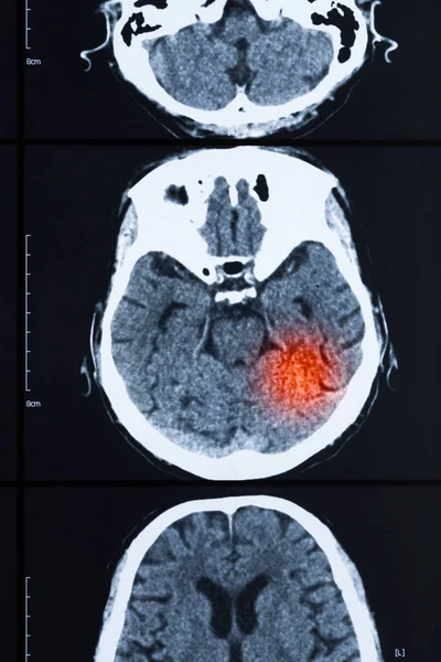 human brain skull bones xray