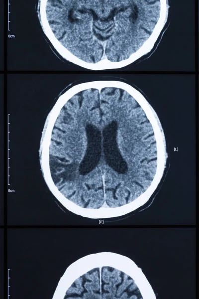 human brain skull bones xray