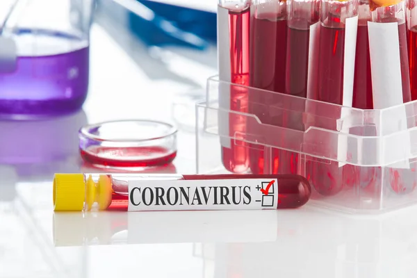 Bloedtest Positief Coronavirus Resultaat Sars Cov — Stockfoto