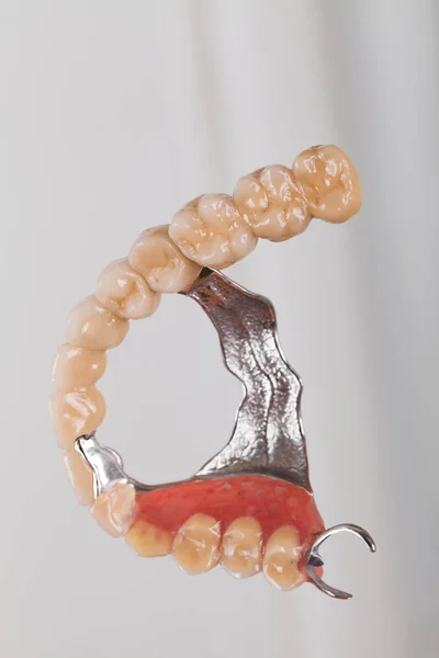 Prótese esquelética - arte da dentadura — Fotografia de Stock