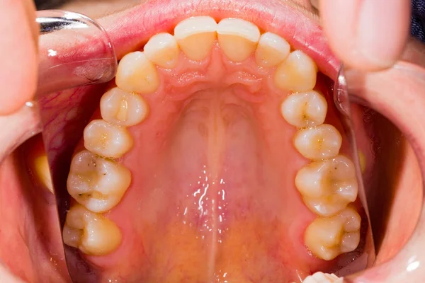 A Anatomia dentária — Fotografia de Stock