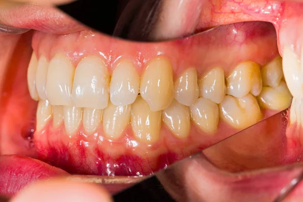 Zubní anatomii — Stock fotografie