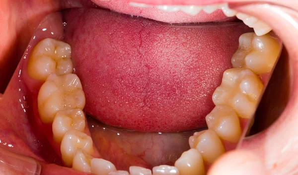Bir diş anatomisi — Stok fotoğraf