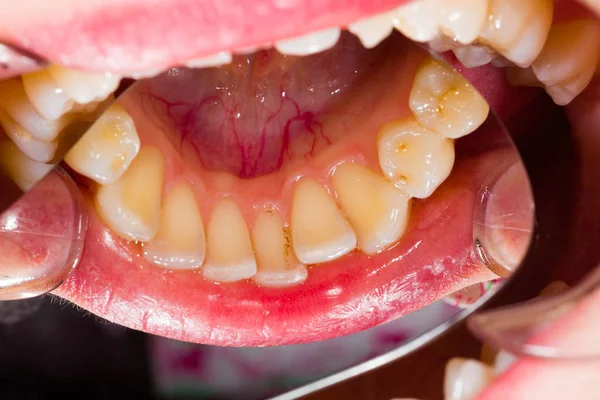 Bir diş anatomisi — Stok fotoğraf