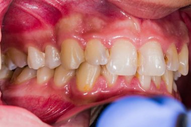 Bu böyle aynaya bakıyor