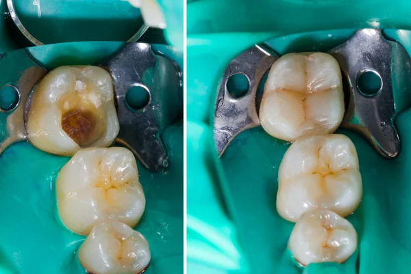 Imiter la nature en dentisterie — Photo