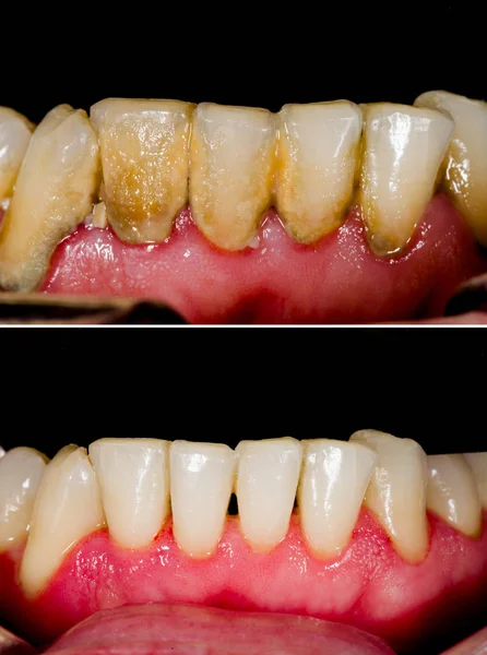 Higiena jamy ustnej — Zdjęcie stockowe