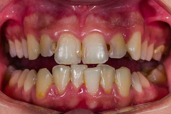 Esempi diagnostici dentali — Foto Stock