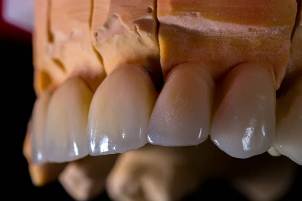 Lavoro di odontotecnico — Foto Stock