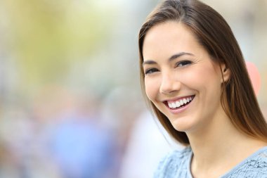 Kadın ile mükemmel bir gülümseme ve beyaz dişler-seni arıyorlar