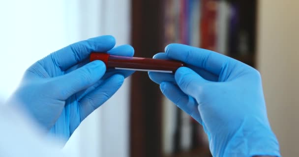 Lekarz utrzymujący pandemię Koronawirusa 2019-nCoV Próbka krwi dodatnia probówka. Lekarz noszący maskę medyczną i rękawice i pokazujący rurkę do badań krwi pacjenta zawierającą wirus korony (COVID-19)) — Wideo stockowe