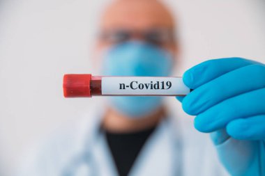 Doktor Holding Coronavirus 2019 nCoV Kan Numunesi Pozitif Test Tüpü. Tıbbi maske takan ve eldiven takan doktor, hastanın korona virüsü içeren kan test tüpünü göstermektedir (COVID-19)