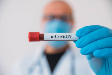 Doktor Holding Coronavirus 2019 nCoV Kan Numunesi Pozitif Test Tüpü. Tıbbi maske takan ve eldiven takan doktor, hastanın korona virüsü içeren kan test tüpünü göstermektedir (COVID-19)