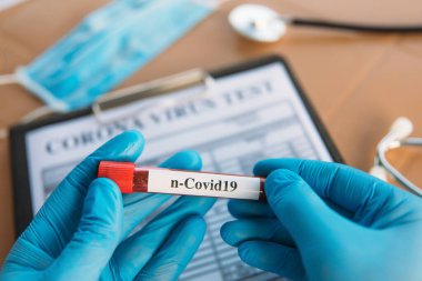 Doktor Holding Coronavirus 2019 nCoV Kan Numunesi Pozitif Test Tüpü. Tıbbi maske takan ve eldiven takan doktor, hastanın korona virüsü içeren kan test tüpünü göstermektedir (COVID-19)