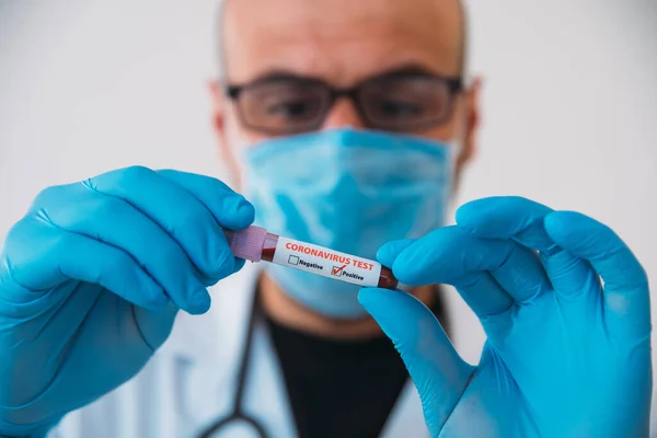 Medico Holding Pandemic Coronavirus 2019 Ncov Campione Sangue Positivo Test — Foto Stock