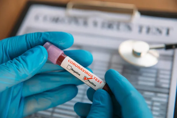 Arzt Mit Pandemischem Coronavirus 2019 Ncov Blutprobe Positiv Getestet Arzt — Stockfoto