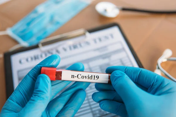 Doctor Holding Pandemic Coronavirus 2019 Ncov Αίμα Δείγμα Θετική Σωλήνα — Φωτογραφία Αρχείου